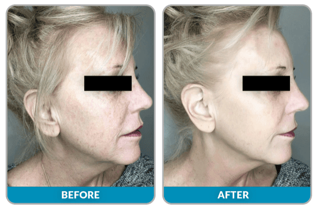 SUNSHINE COSMETIC CLINIC & MEDI SPA