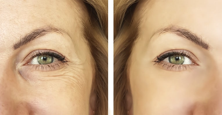SUNSHINE COSMETIC CLINIC & MEDI SPA