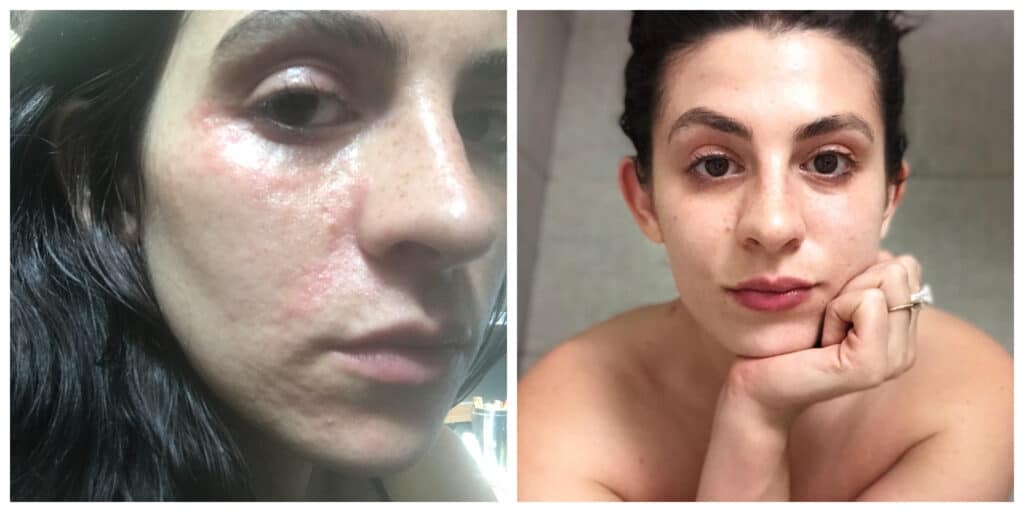 SUNSHINE COSMETIC CLINIC & MEDI SPA