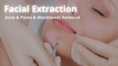 A licensed practitioner using sterile tools to carefully clear congested pores and blackheads for a client in Mississauga.