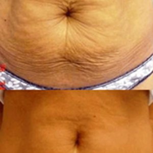 SUNSHINE COSMETIC CLINIC & MEDI SPA