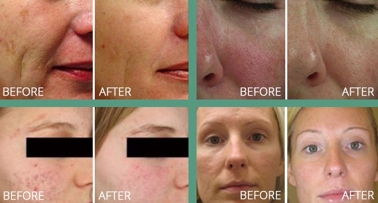 SUNSHINE COSMETIC CLINIC & MEDI SPA