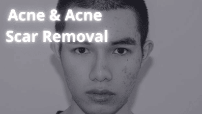 SUNSHINE COSMETIC CLINIC & MEDI SPA