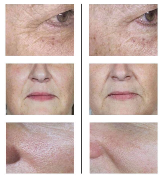 SUNSHINE COSMETIC CLINIC & MEDI SPA