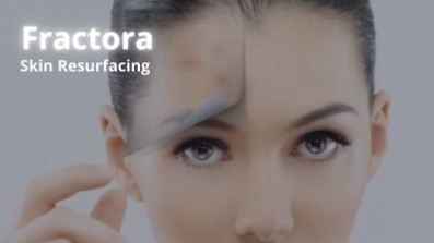 Skin tightening in Mississauga 4