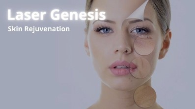 Skin tightening in Mississauga 5