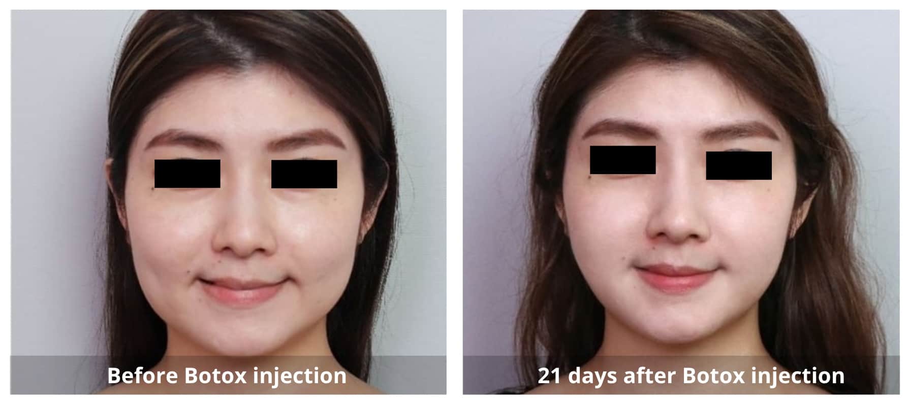 SUNSHINE COSMETIC CLINIC & MEDI SPA
