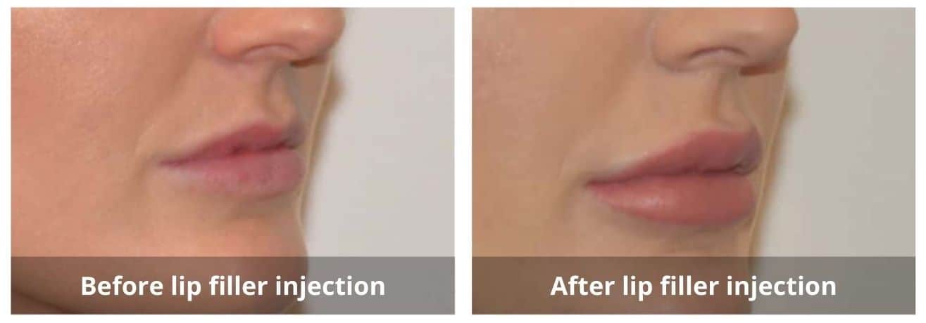 SUNSHINE COSMETIC CLINIC & MEDI SPA