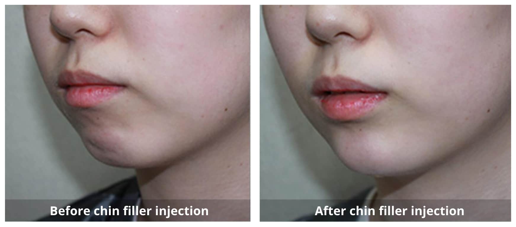 SUNSHINE COSMETIC CLINIC & MEDI SPA