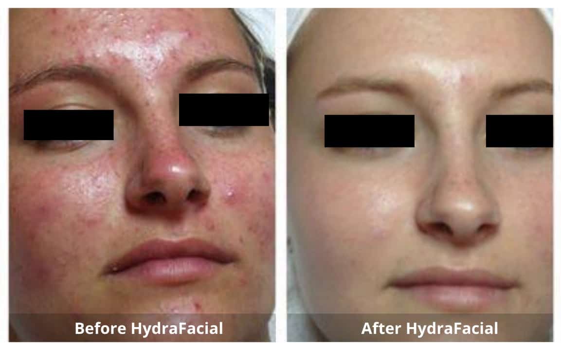 SUNSHINE COSMETIC CLINIC & MEDI SPA
