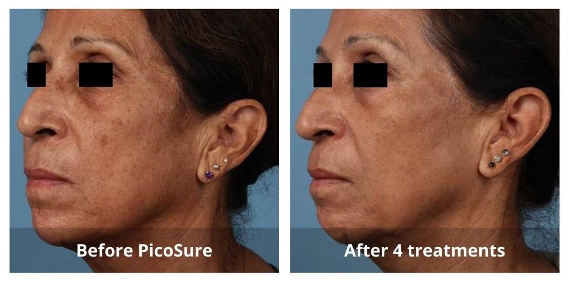 SUNSHINE COSMETIC CLINIC & MEDI SPA
