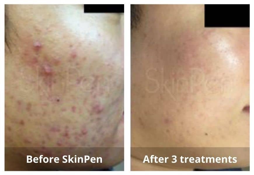 SUNSHINE COSMETIC CLINIC & MEDI SPA
