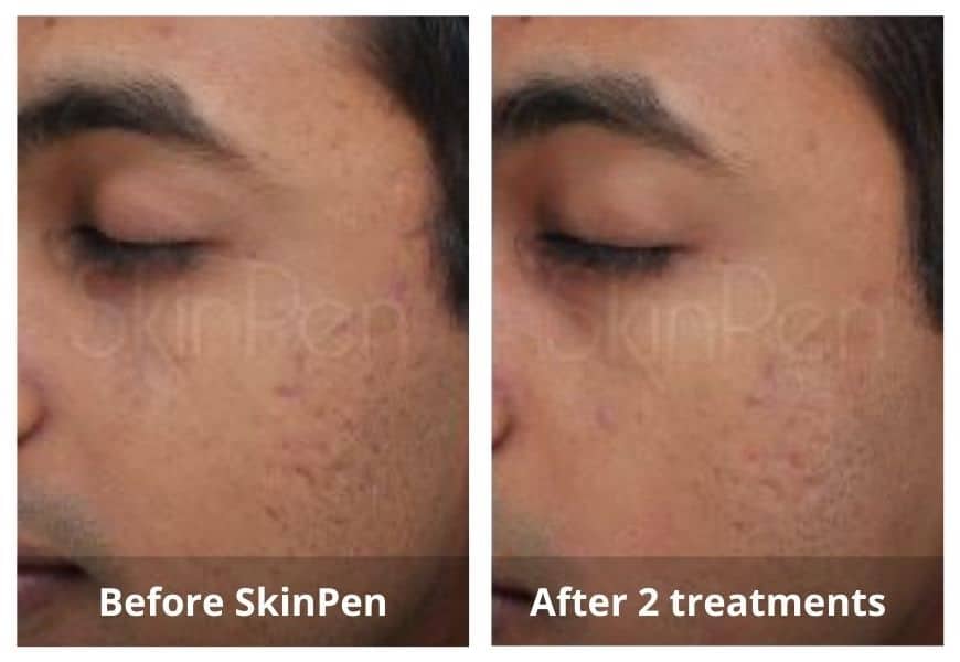 SUNSHINE COSMETIC CLINIC & MEDI SPA