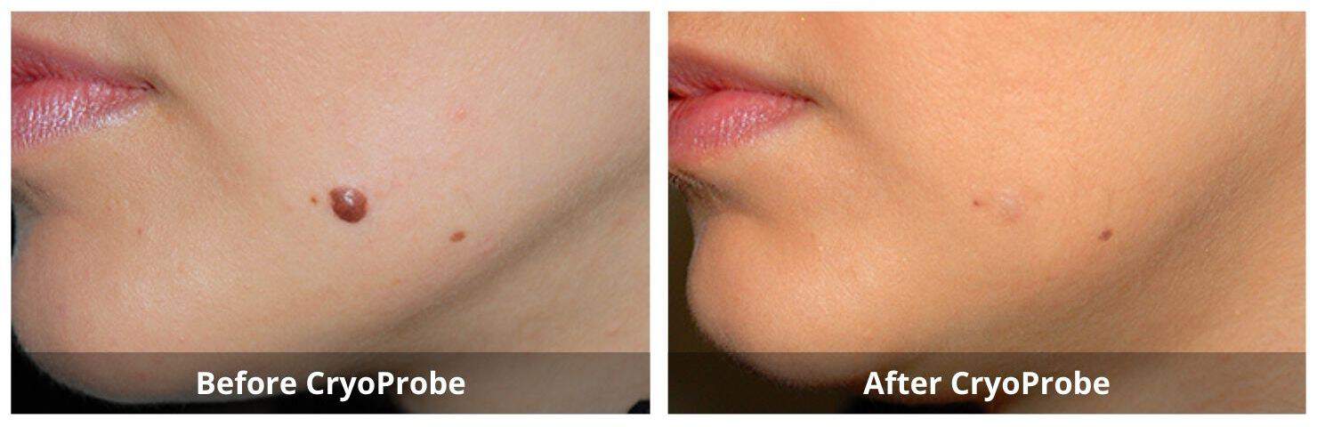 SUNSHINE COSMETIC CLINIC & MEDI SPA