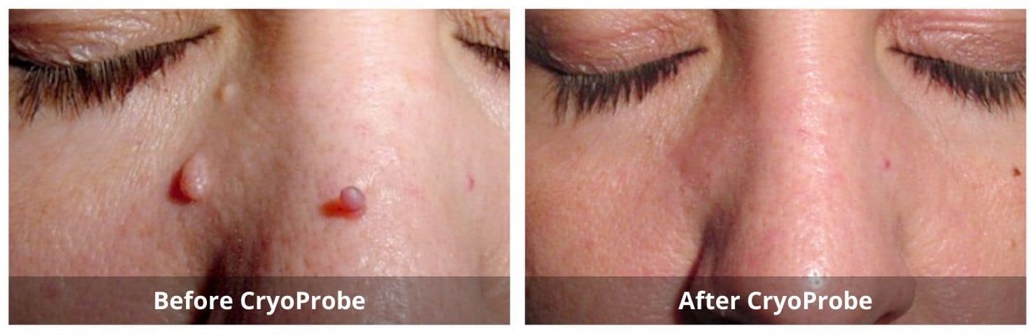 SUNSHINE COSMETIC CLINIC & MEDI SPA