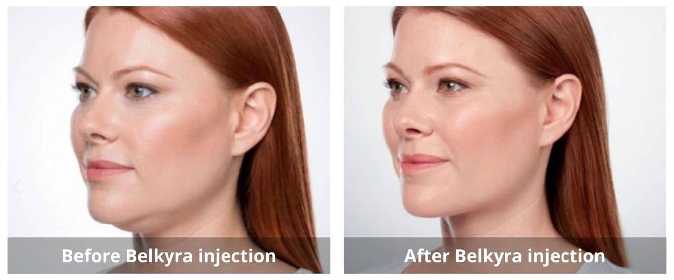 SUNSHINE COSMETIC CLINIC & MEDI SPA