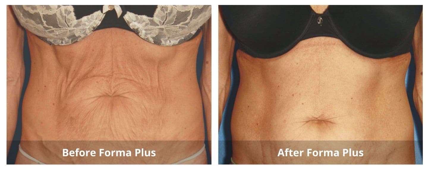 SUNSHINE COSMETIC CLINIC & MEDI SPA