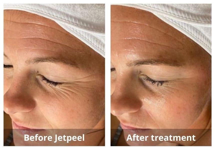 SUNSHINE COSMETIC CLINIC & MEDI SPA