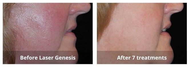 SUNSHINE COSMETIC CLINIC & MEDI SPA