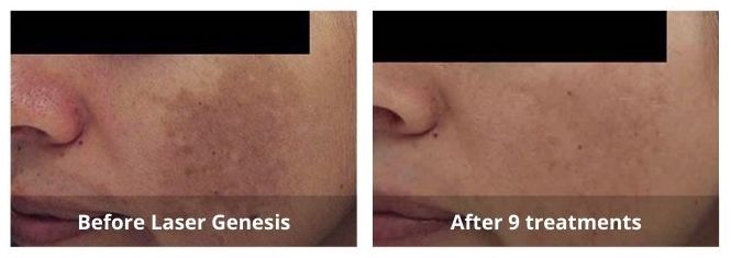 SUNSHINE COSMETIC CLINIC & MEDI SPA