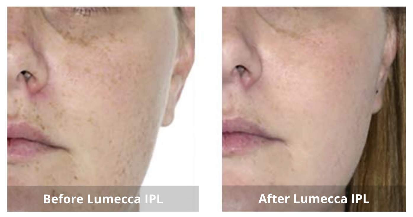 SUNSHINE COSMETIC CLINIC & MEDI SPA