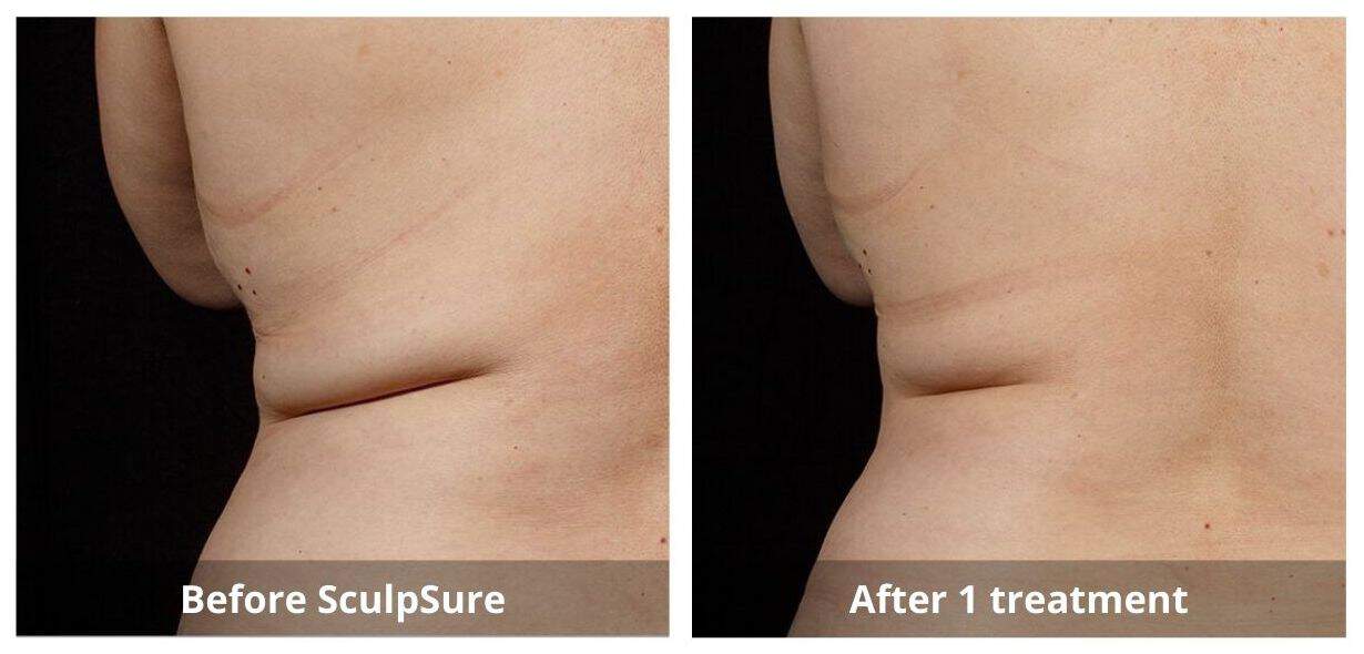 SUNSHINE COSMETIC CLINIC & MEDI SPA