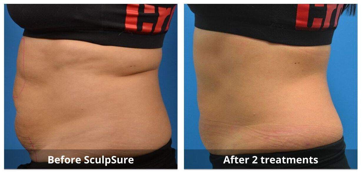 SUNSHINE COSMETIC CLINIC & MEDI SPA