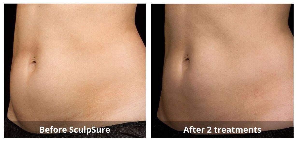 SUNSHINE COSMETIC CLINIC & MEDI SPA
