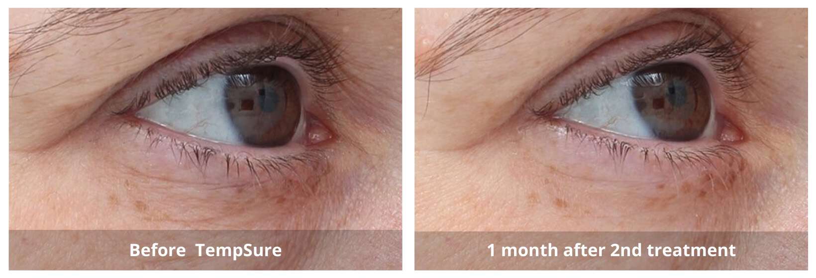 SUNSHINE COSMETIC CLINIC & MEDI SPA