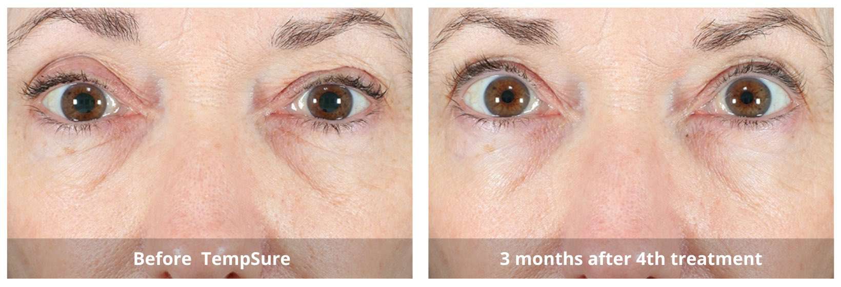SUNSHINE COSMETIC CLINIC & MEDI SPA
