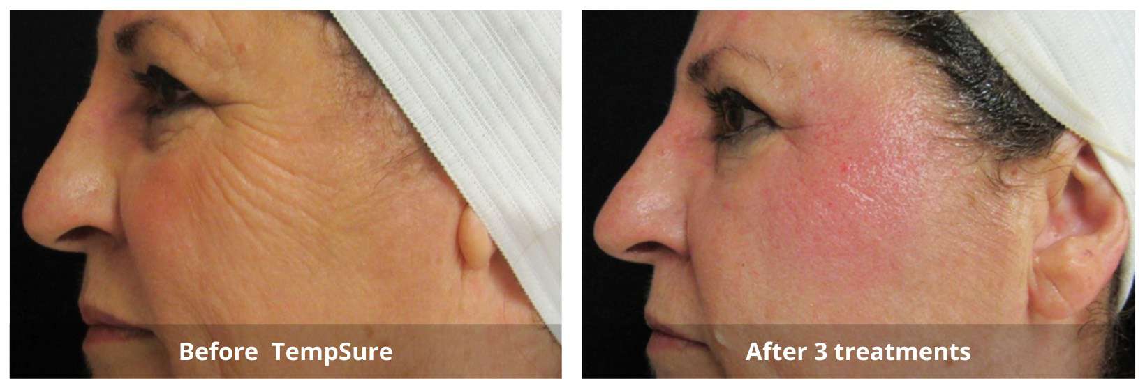 SUNSHINE COSMETIC CLINIC & MEDI SPA