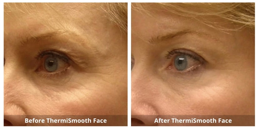 SUNSHINE COSMETIC CLINIC & MEDI SPA