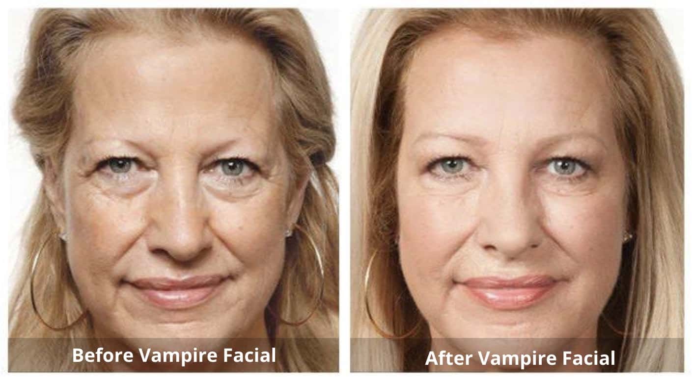 SUNSHINE COSMETIC CLINIC & MEDI SPA