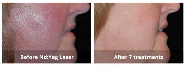 SUNSHINE COSMETIC CLINIC & MEDI SPA