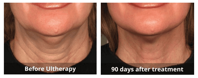 SUNSHINE COSMETIC CLINIC & MEDI SPA