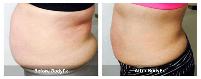 SUNSHINE COSMETIC CLINIC & MEDI SPA