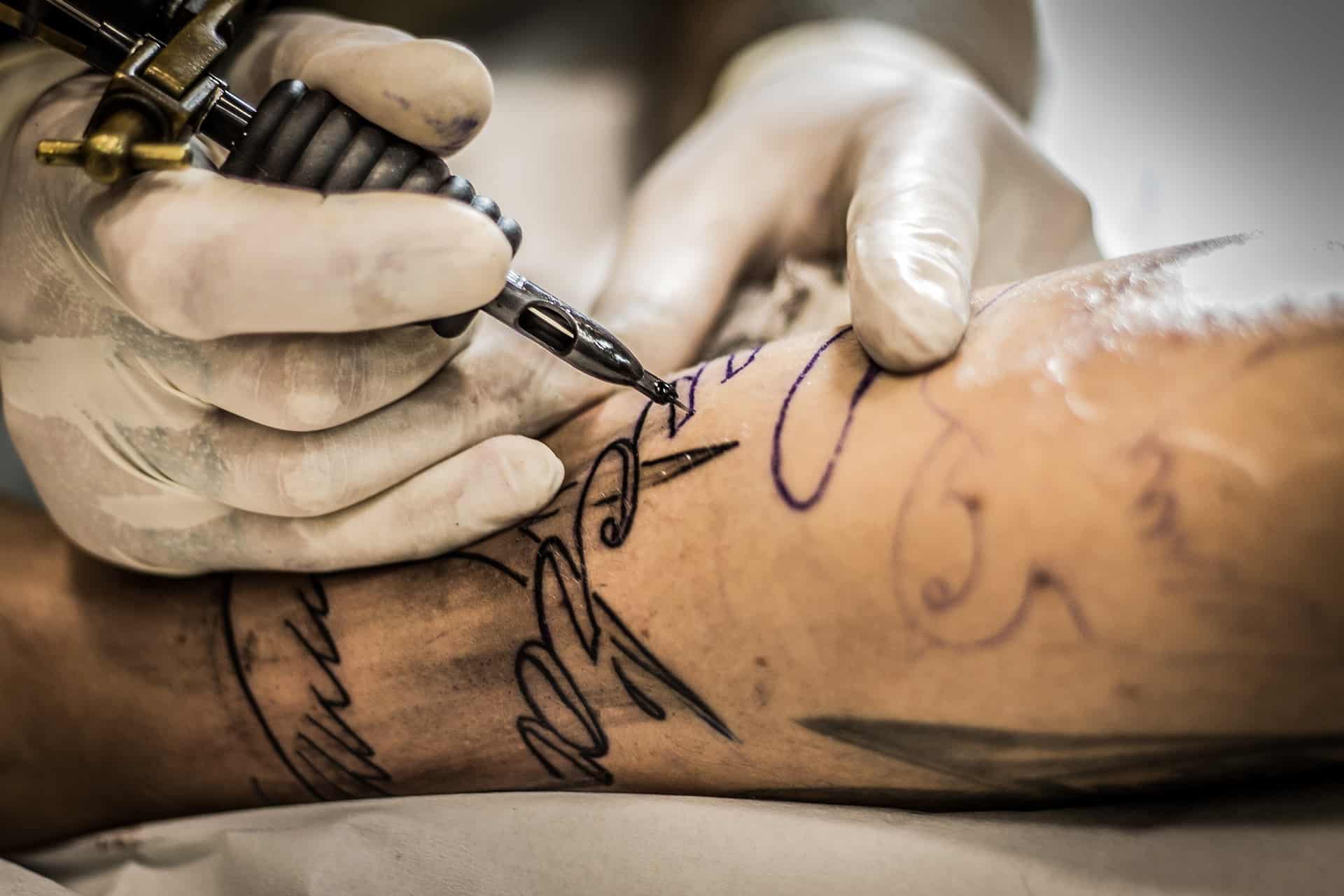 Is Laser Tattoo Removal Pain-Free?