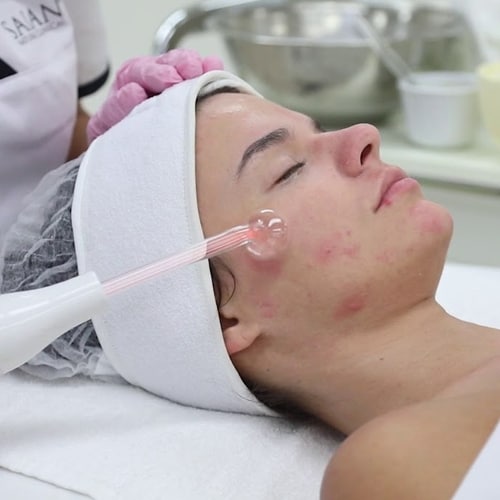 We provide acne facials and we are the top acne clinic in Mississauga. Contact us for more details.
