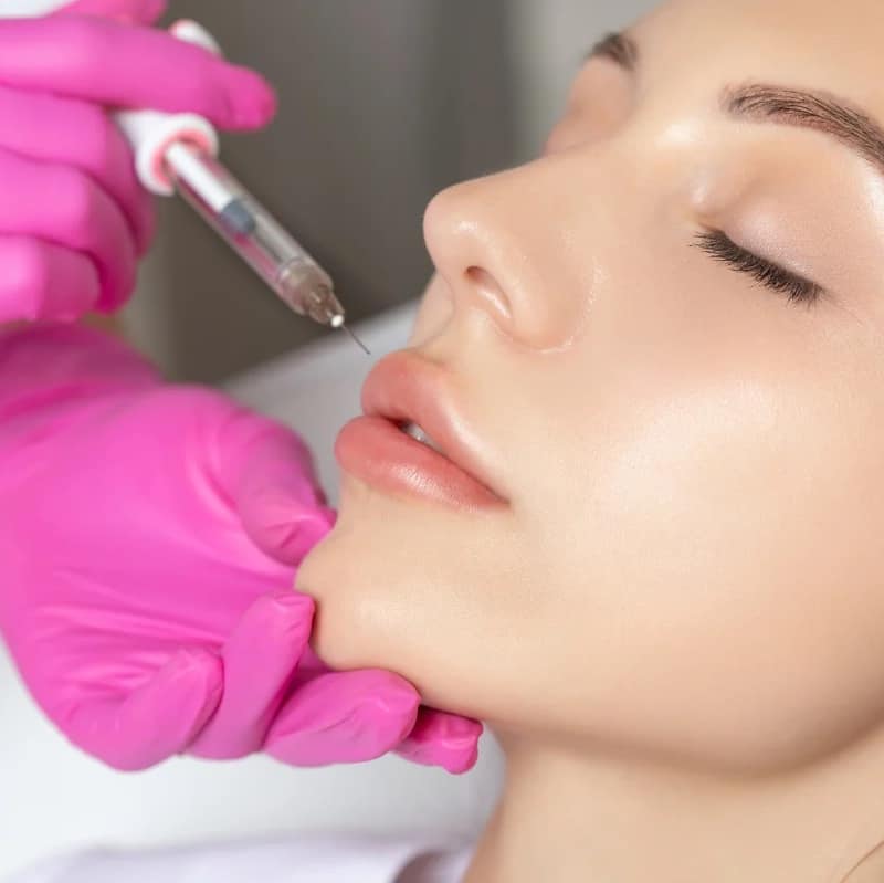 We provide lip filler injections in the Mississauga area.