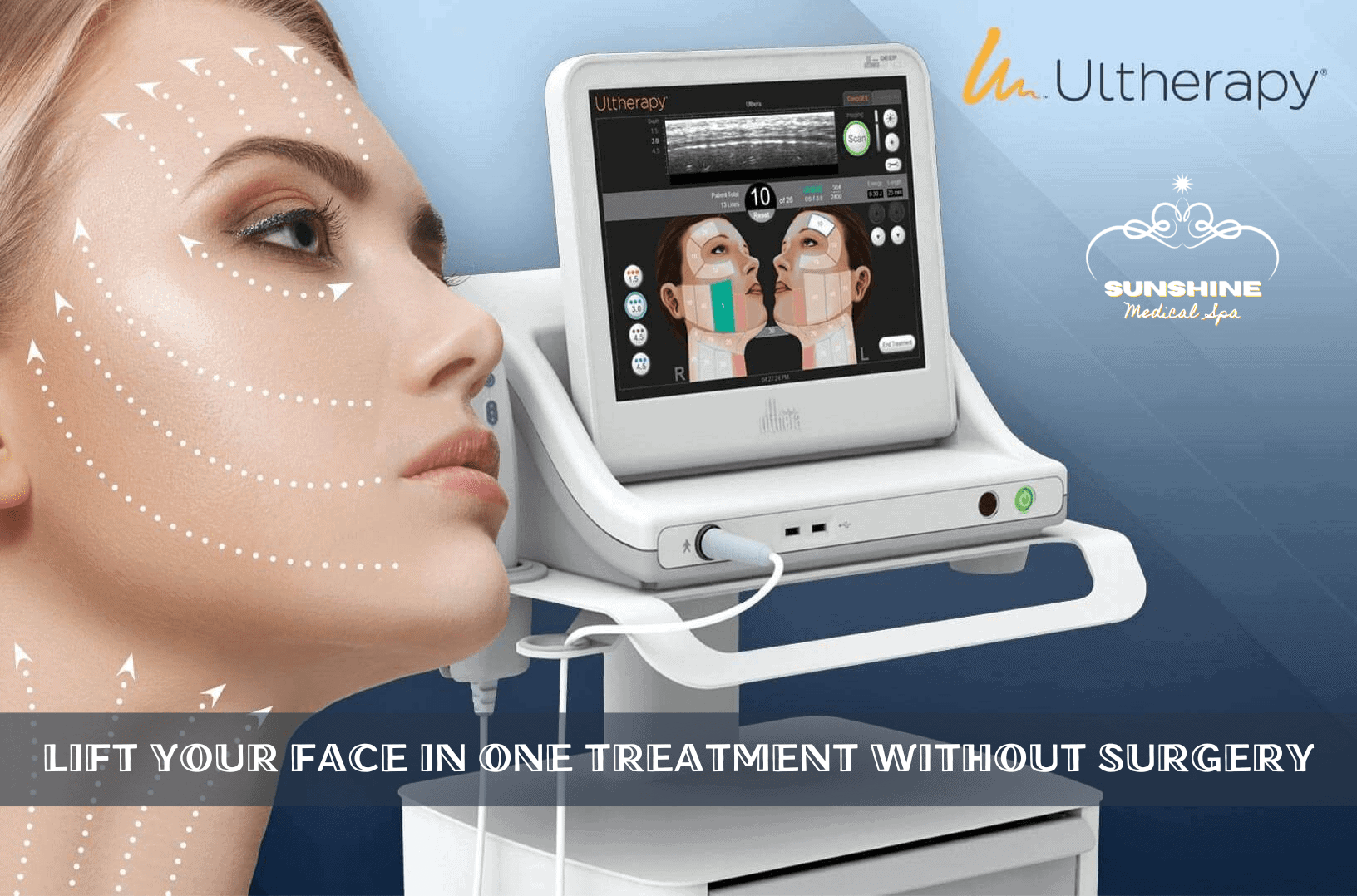 We provide 10+ skin tightening and face lift treatments in Mississauga. Ultherapy is our top choice, which can lift your face in only one treatment with results last for years.