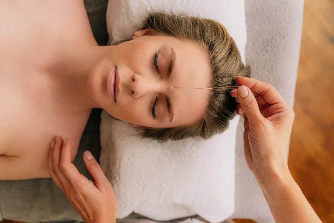 A lady ready for her facial acupuncture in Mississauga