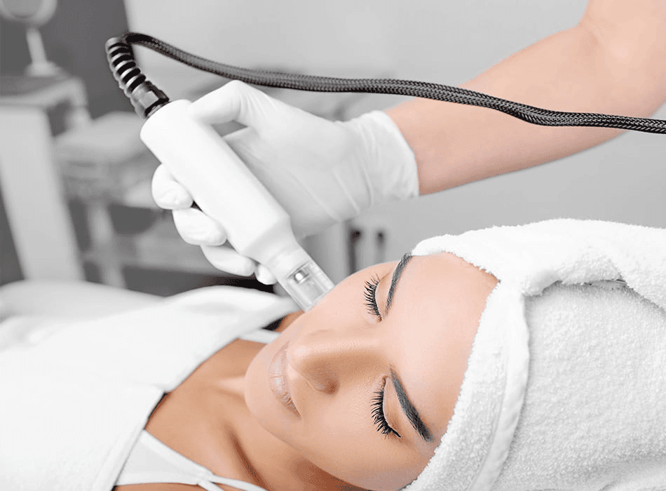Mesotherapy Mississauga treatment in progress