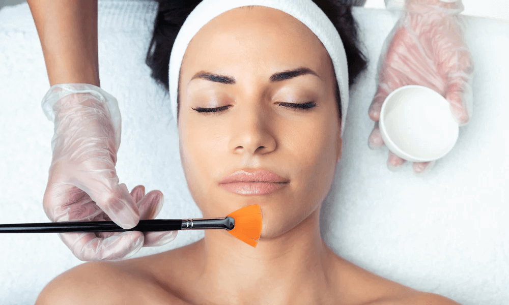 Chemical Peels Mississauga treatment in progress