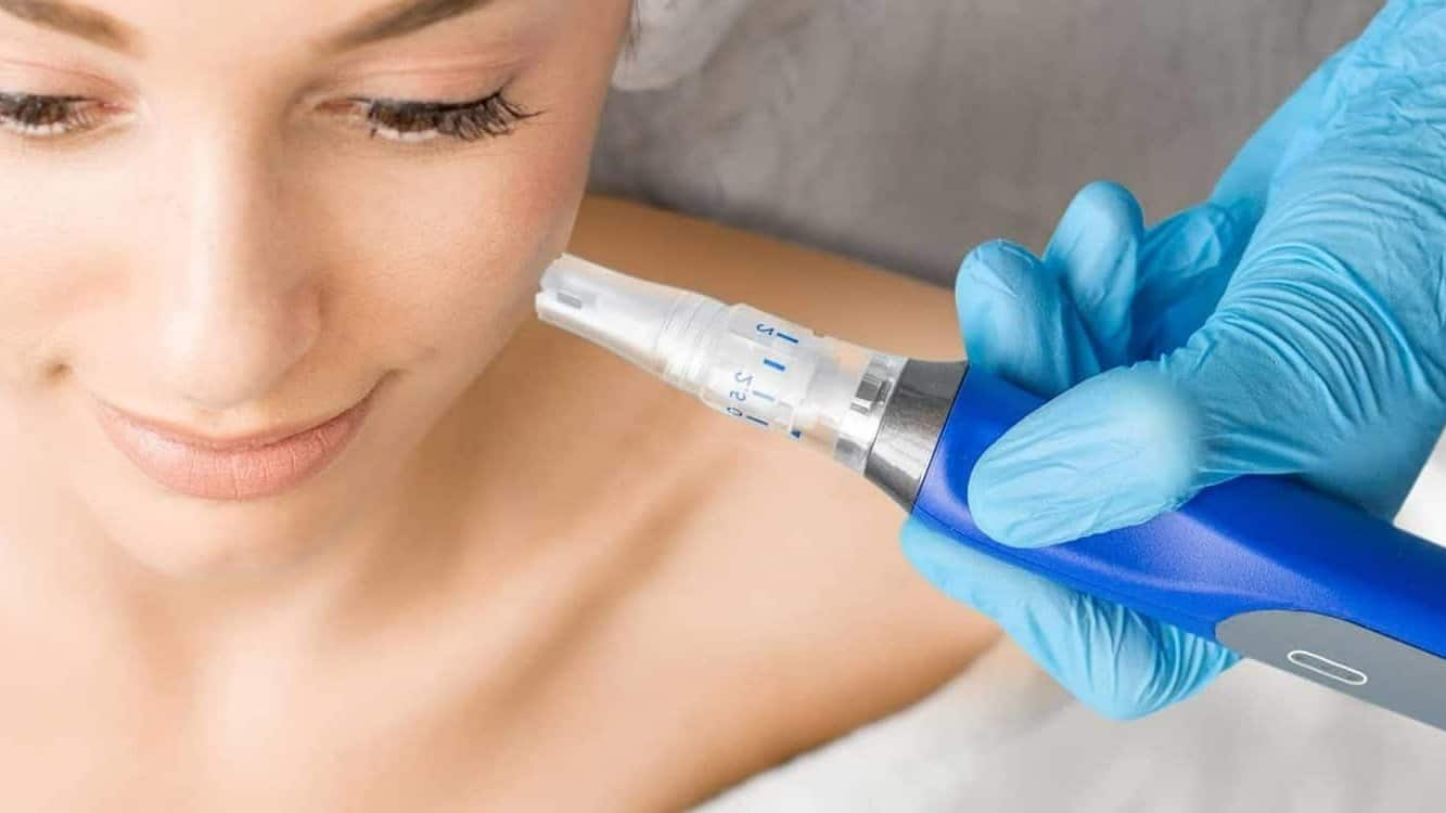 We are a leading Mississauga microneedling clinic and offer SkinPen micro-needling