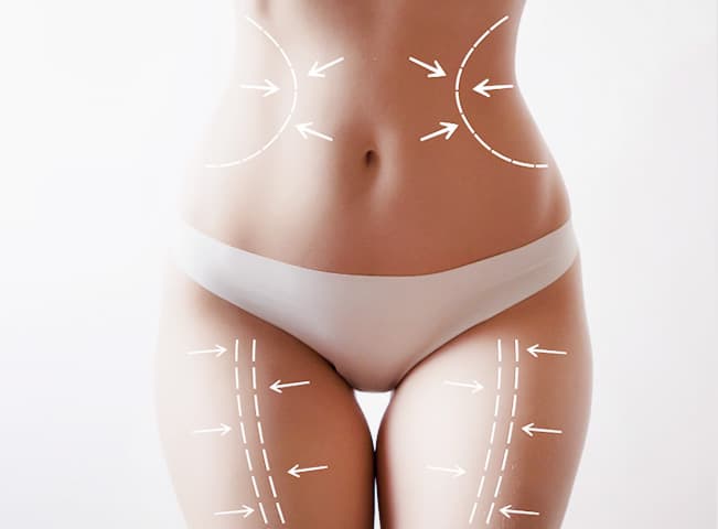 BodyFx® Body Sculpting Mississauga