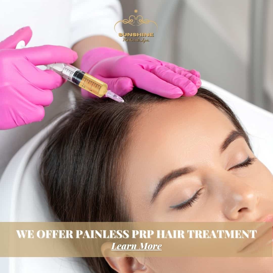 We offer painless prp treatment for hair loss in Mississauga area.