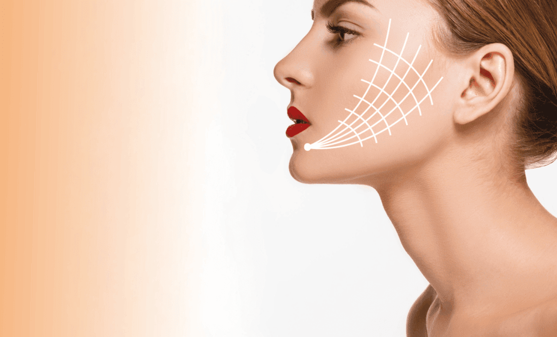 PDO thread lift treatment in Mississauga