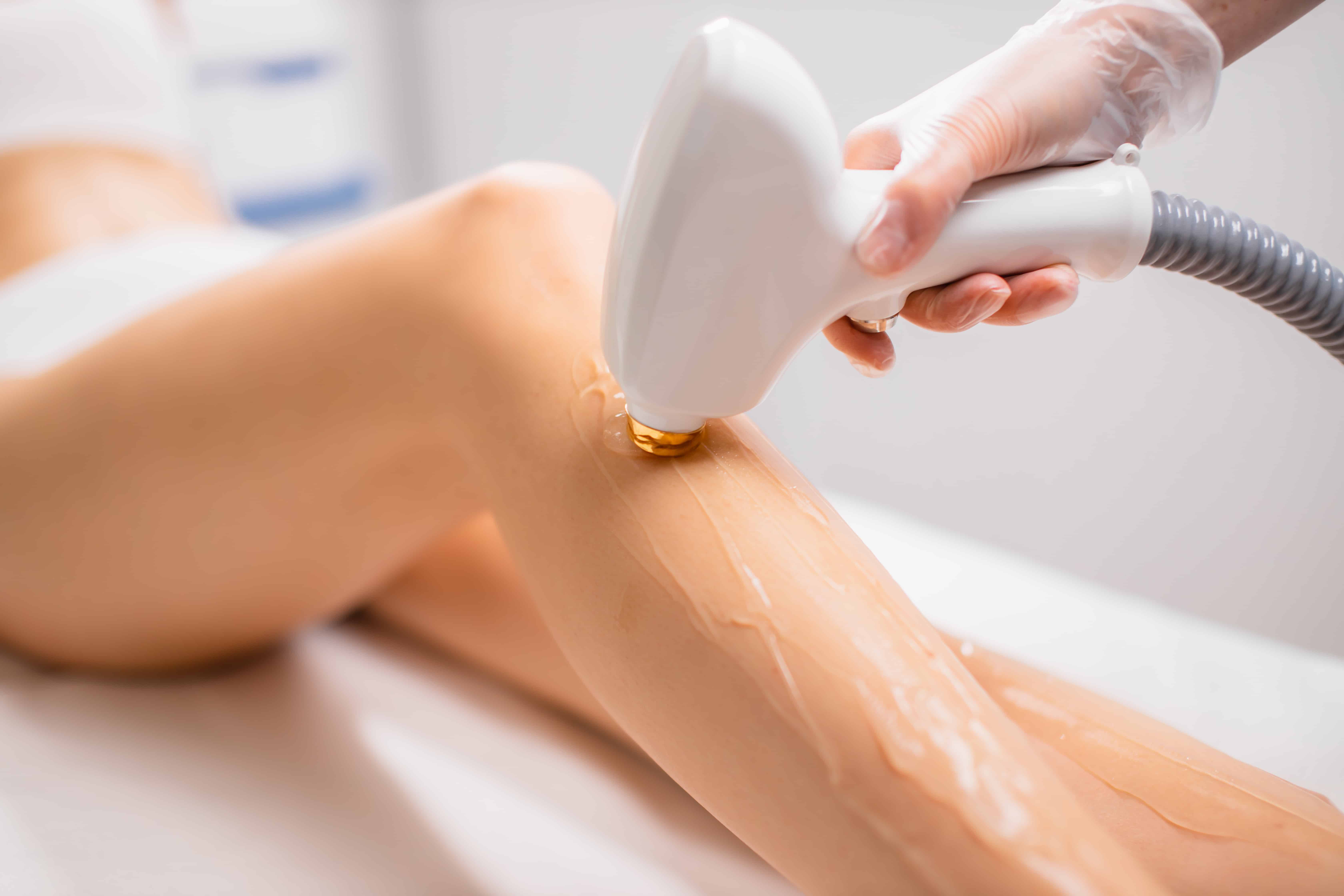 Laser Hair Removal Waterloo & Kitchener