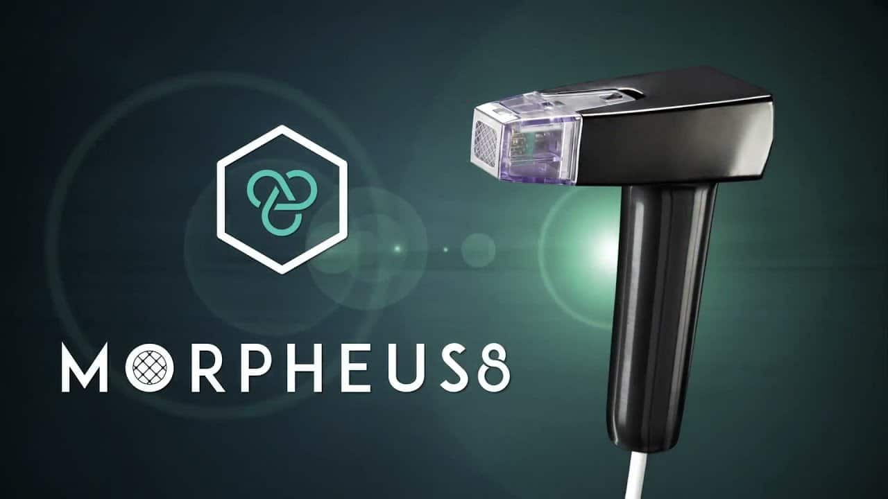 A Complete Guide to Morpheus8 Treatment