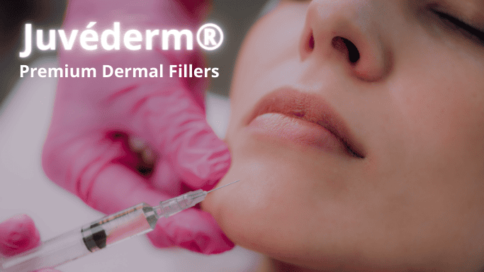 Juvederm in Kitchener Waterloo Cambridge area